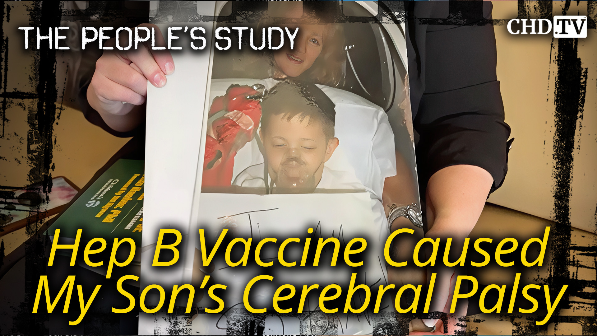 Hep B Vaccine Caused My Son’s Cerebral Palsy