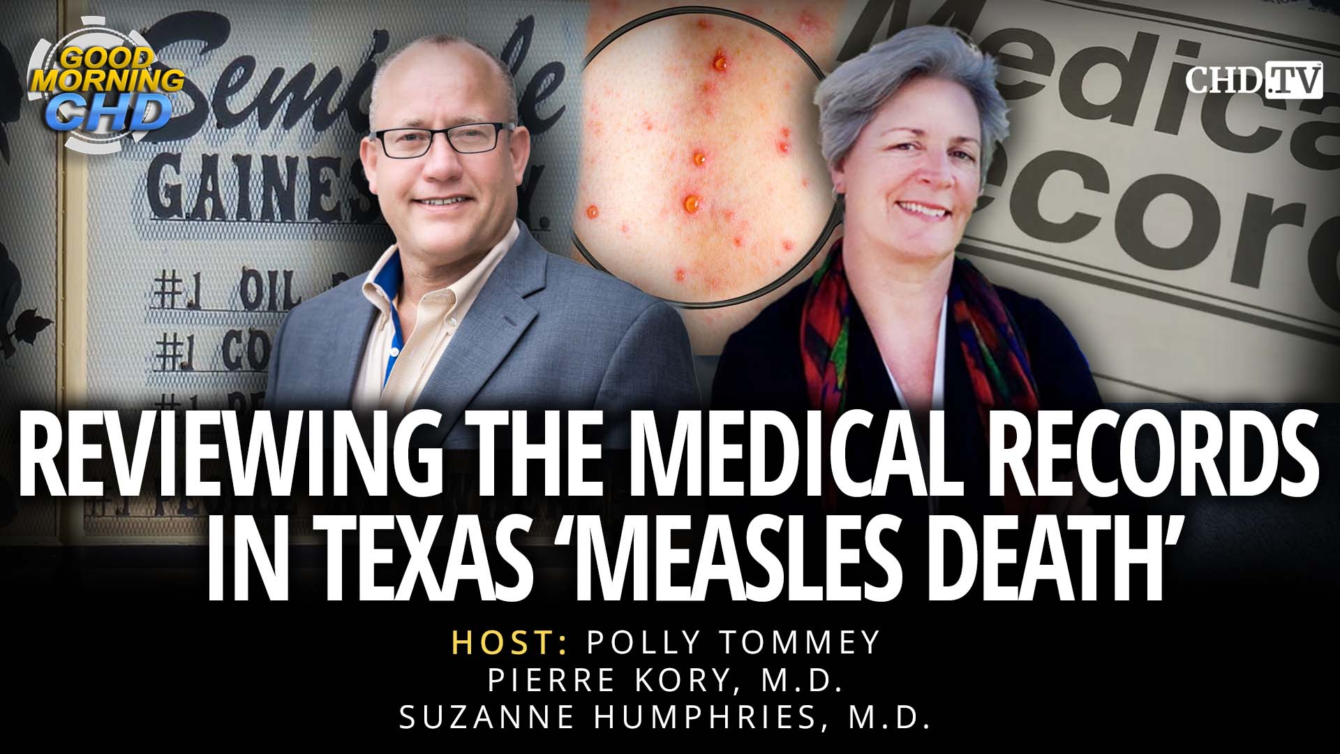 Reviewing The Medical Records in Texas ‘Measles Death’