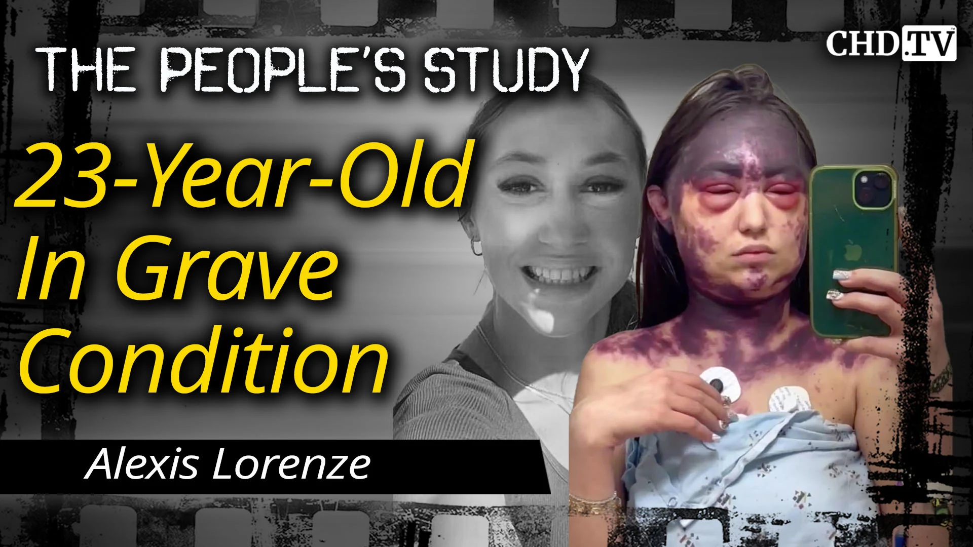 Breaking News: 23-Year-Old In Grave Condition