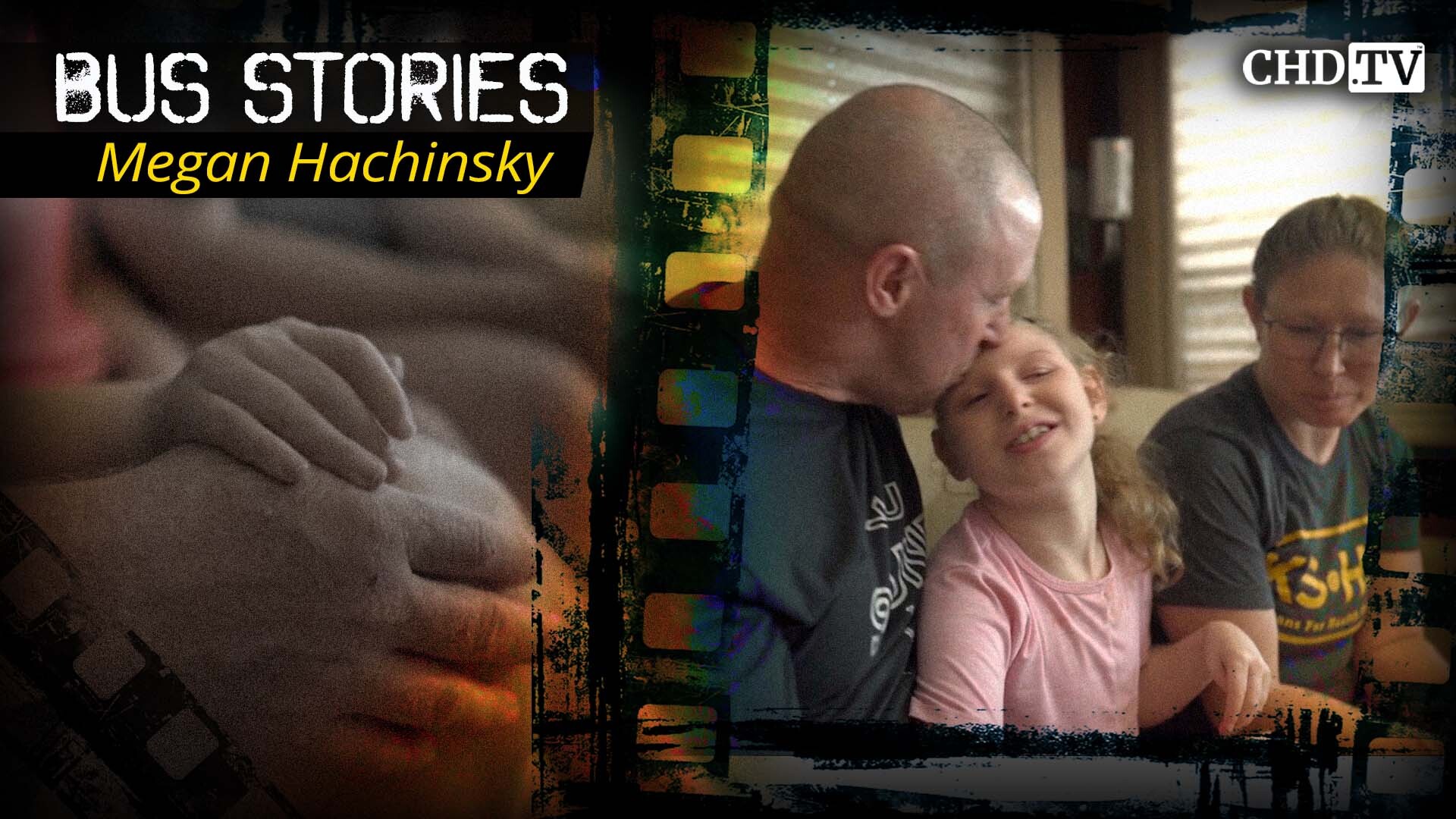 ‘They Told Us Our Daughter Would Never Be Normal’