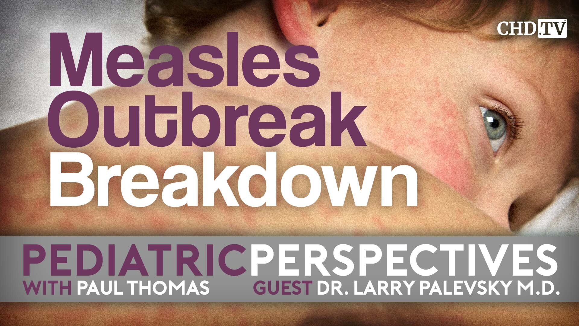 Measles Outbreak Breakdown
