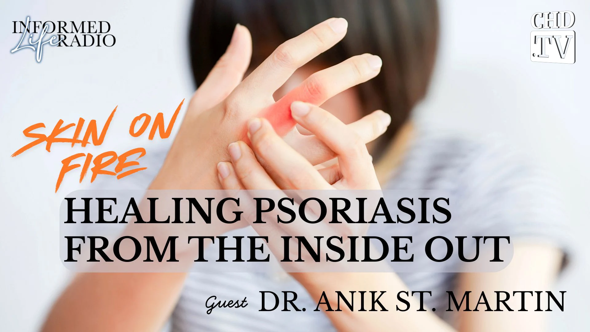 Skin on Fire: Healing Psoriasis From the Inside Out