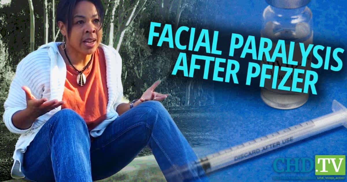 Filmmaker Who Experienced Facial Paralysis After Pfizer Shot Calls for Spreading Humanity on Both Sides of the Vaccine Debate