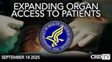 HHS Event: Expanding Organ Access to Patients