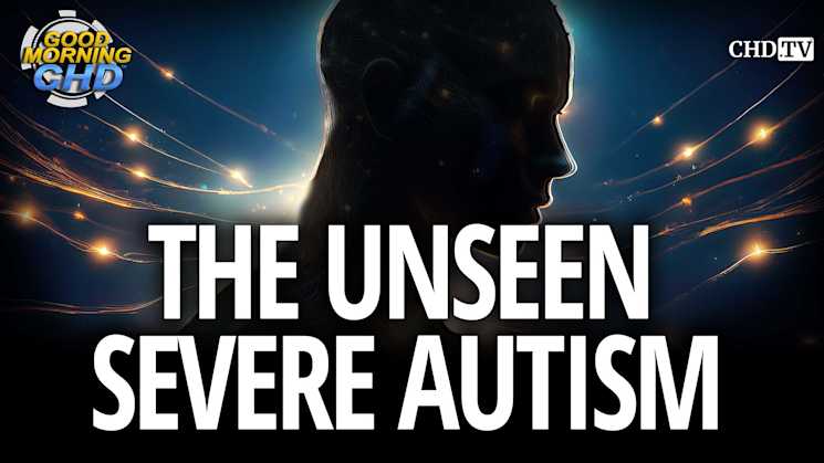 The Unseen Severe Autism