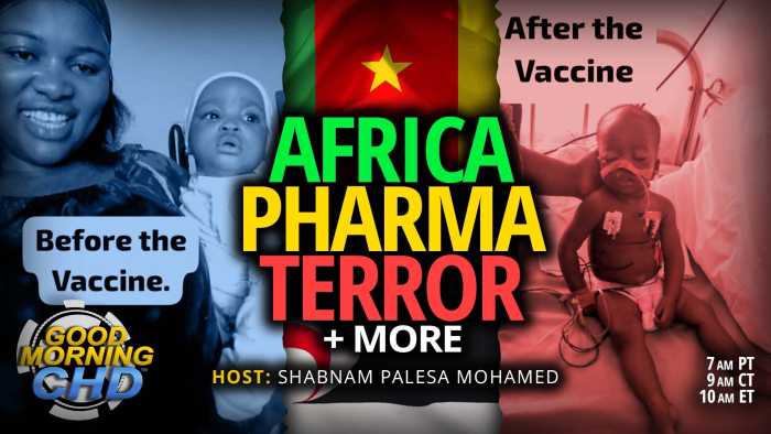 Africa Pharma Terror: 9-Month-Old Paralyzed, Blind + Brain-Damaged After Yellow Fever Vaccine