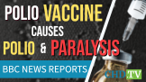 Polio Vaccine Causes Polio + Paralysis BBC News Reports