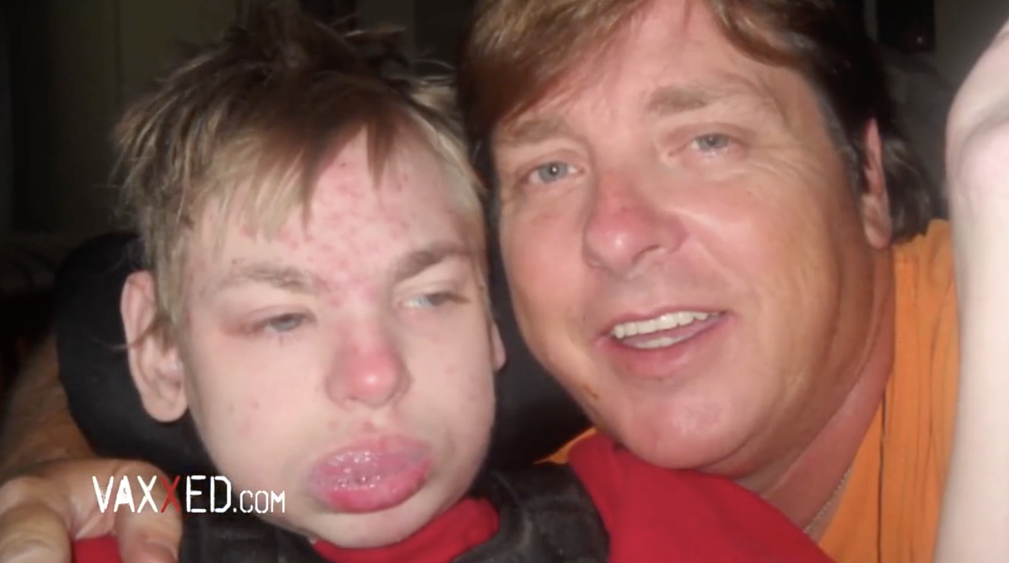 Ronnie Prine for His Son Eric