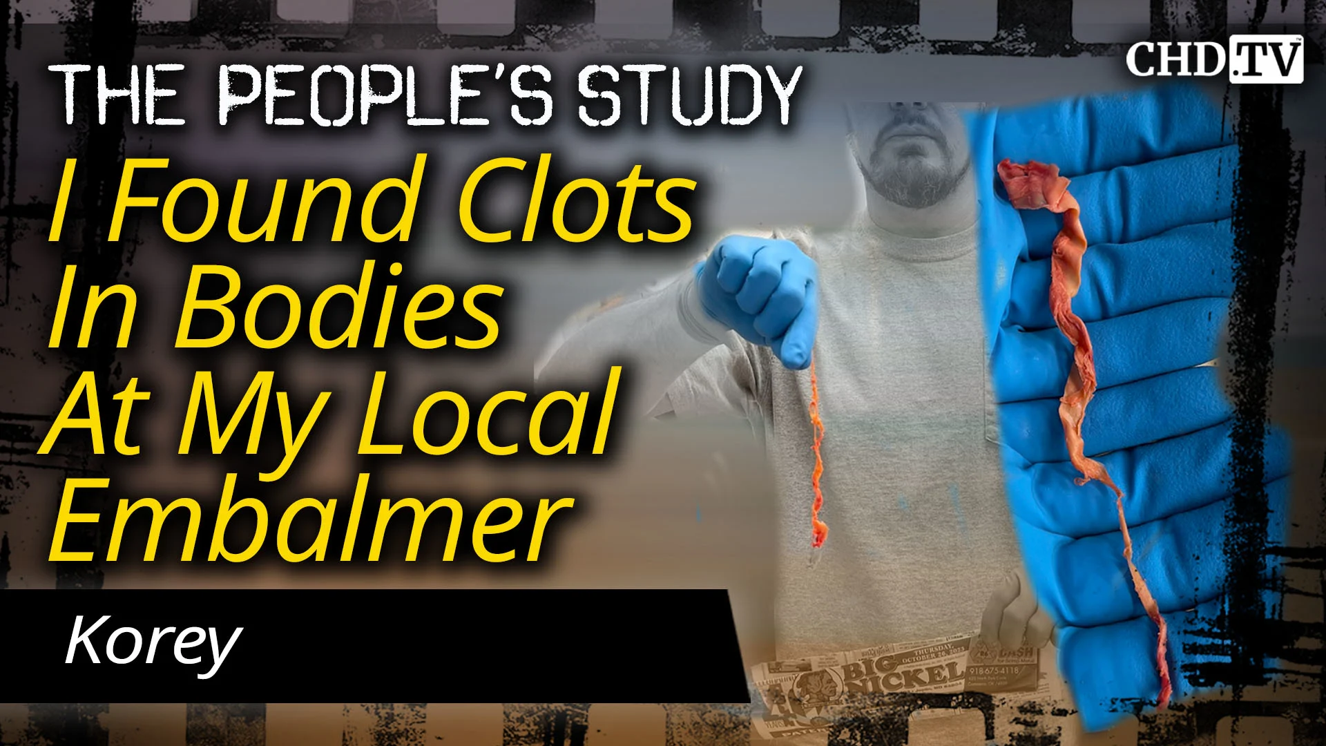 I Found Clots In Bodies At My Local Embalmer