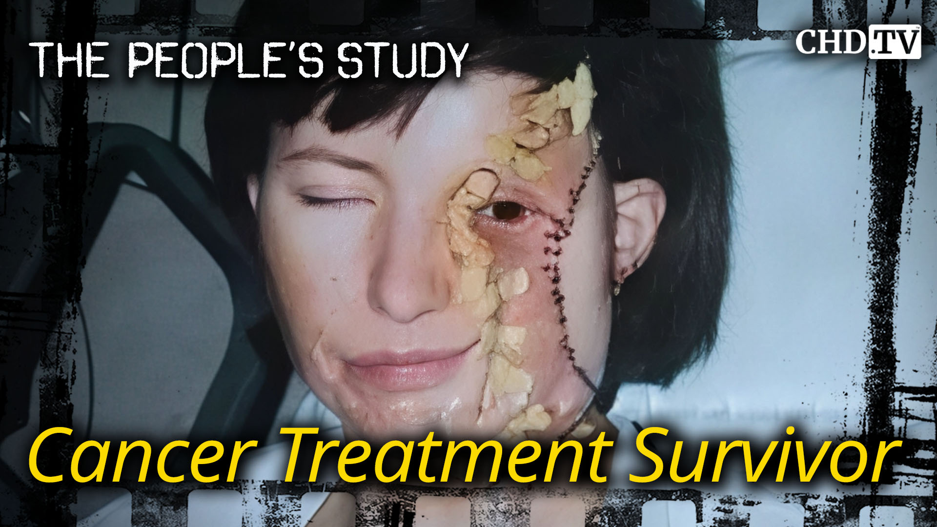 Cancer Treatment Survivor - Judy Ryan