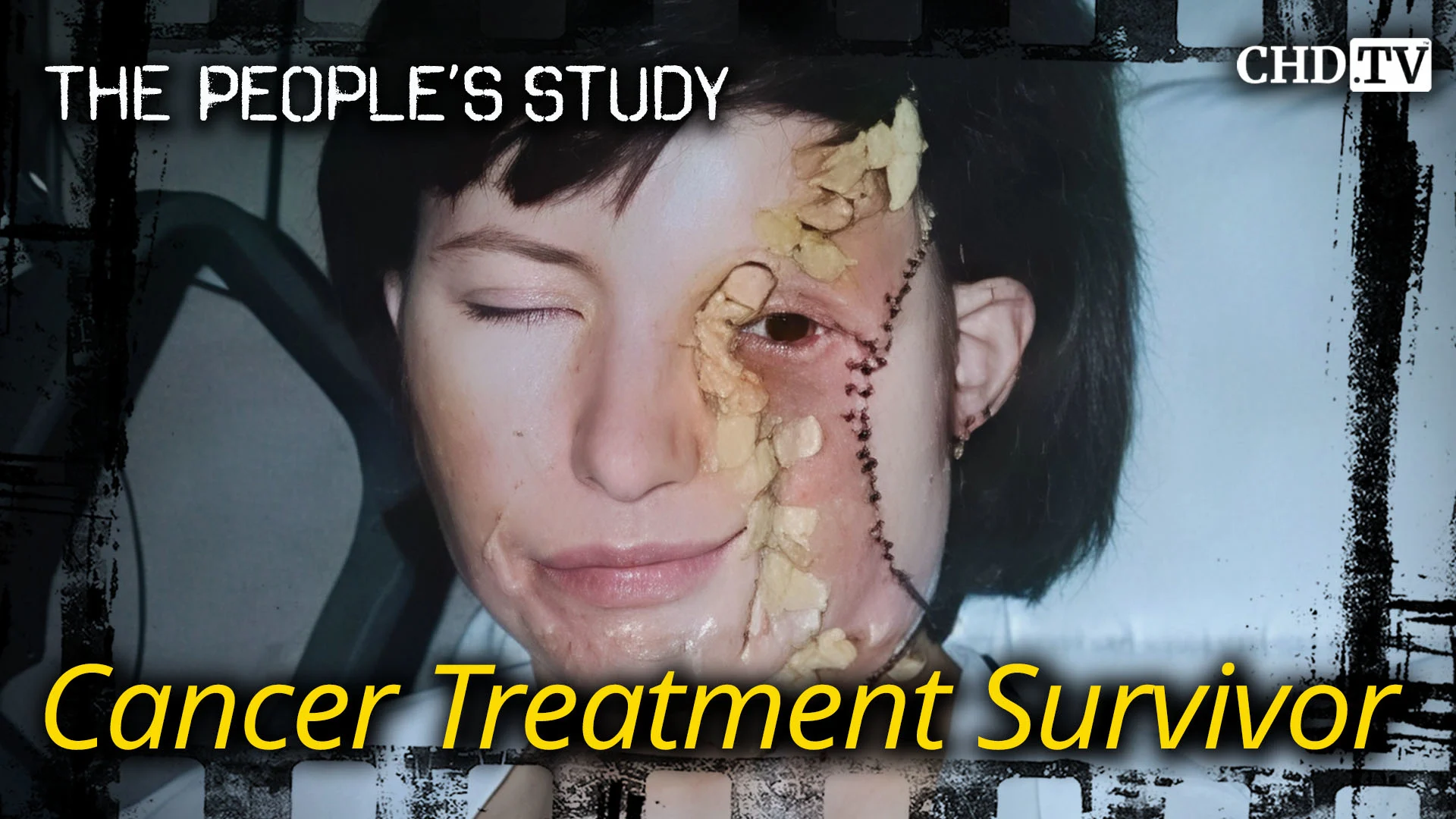 Cancer Treatment Survivor - Judy Ryan