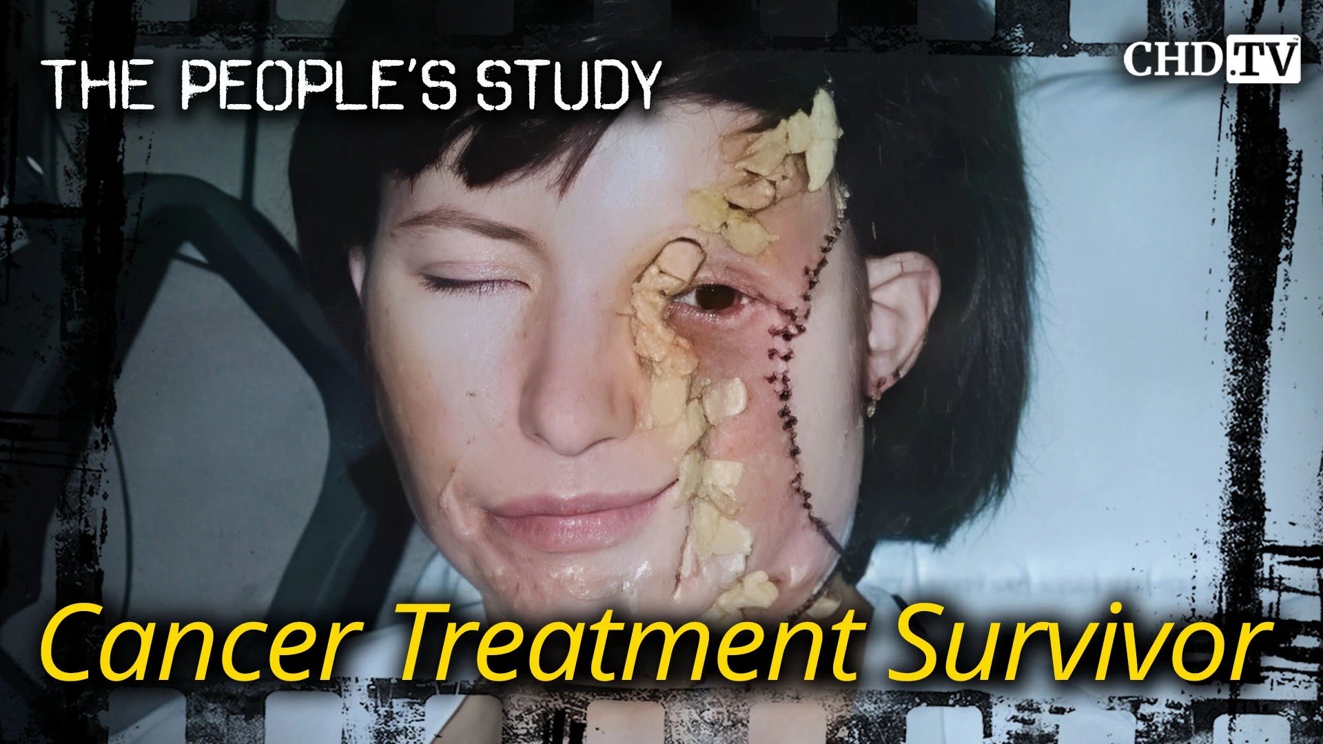 Cancer Treatment Survivor - Judy Ryan