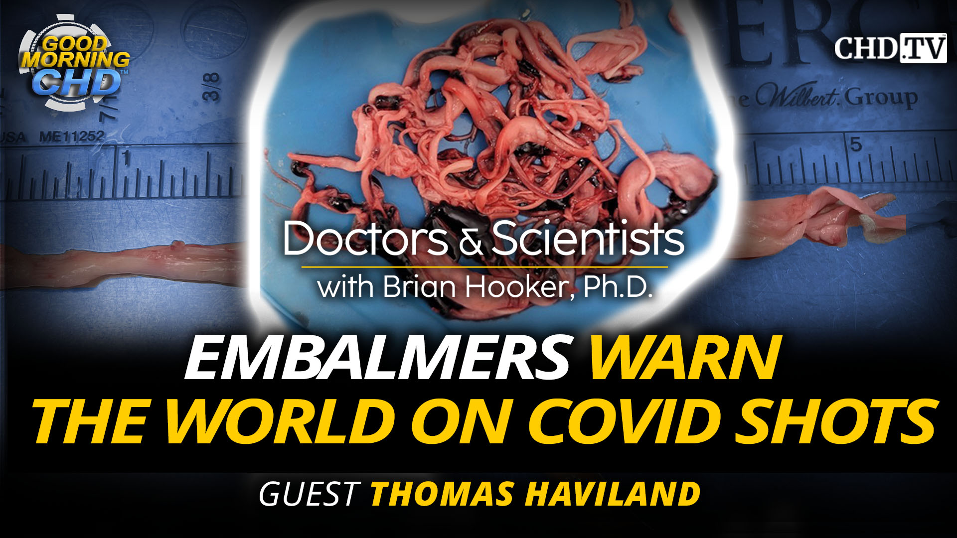 Embalmers Warn the World on COVID Shots