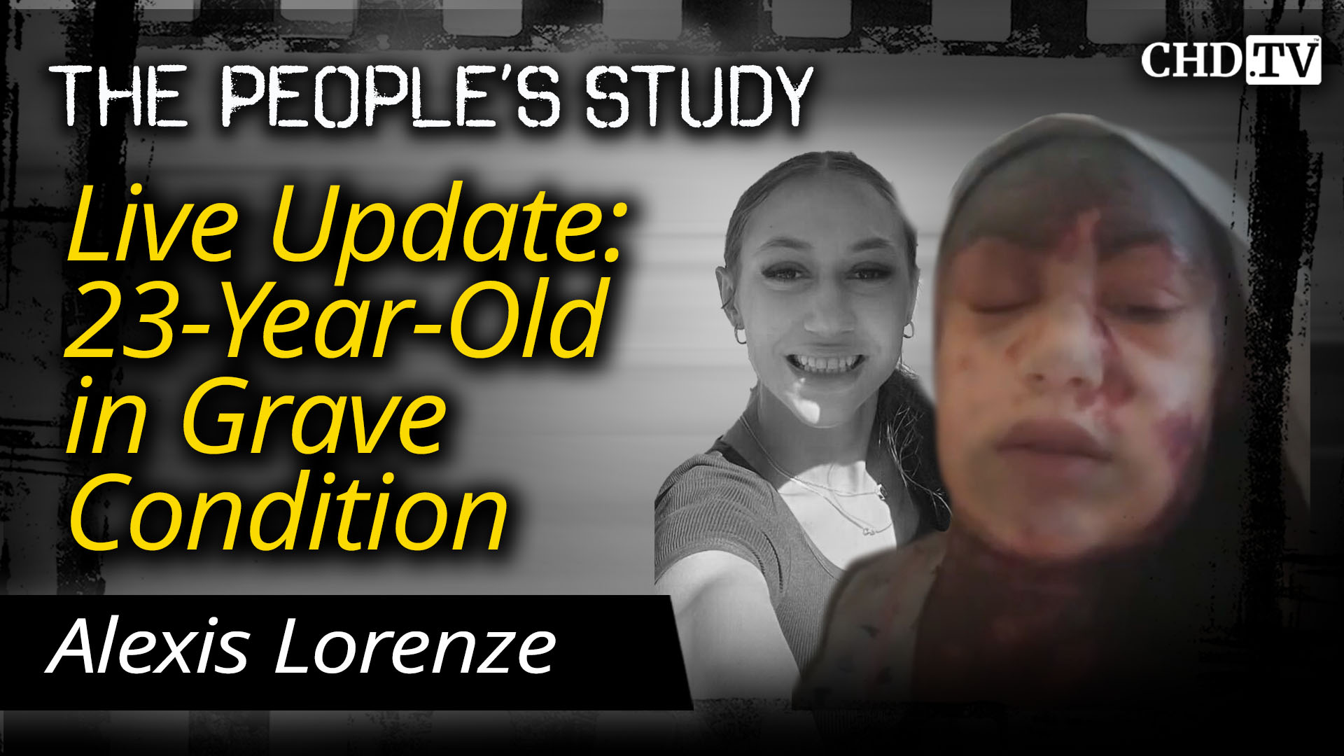 Live Update: 23-Year-Old in Grave Condition | Alexis Lorenze