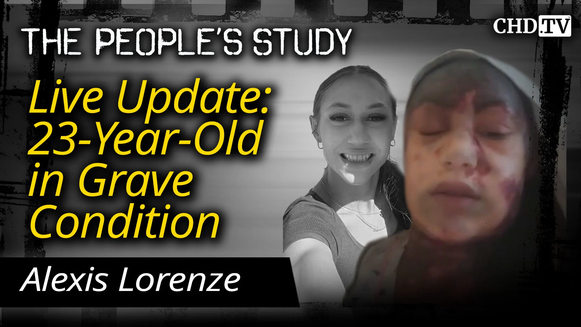 Live Update: 23-Year-Old in Grave Condition | Alexis Lorenze