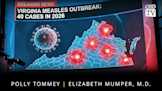 Virginia Measles Outbreak