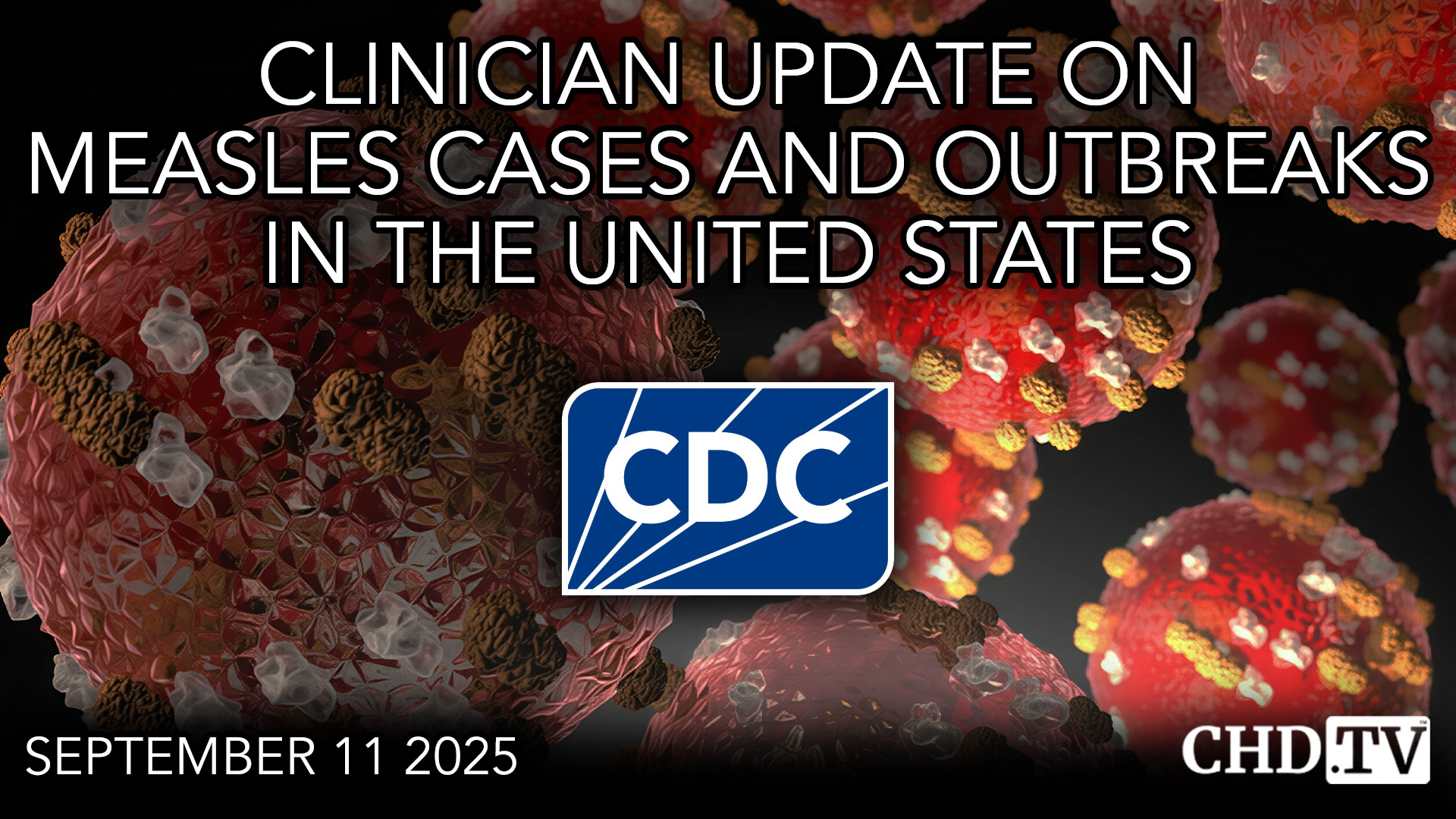 CDC Clinician Update on Measles Cases and Outbreaks in the United States
