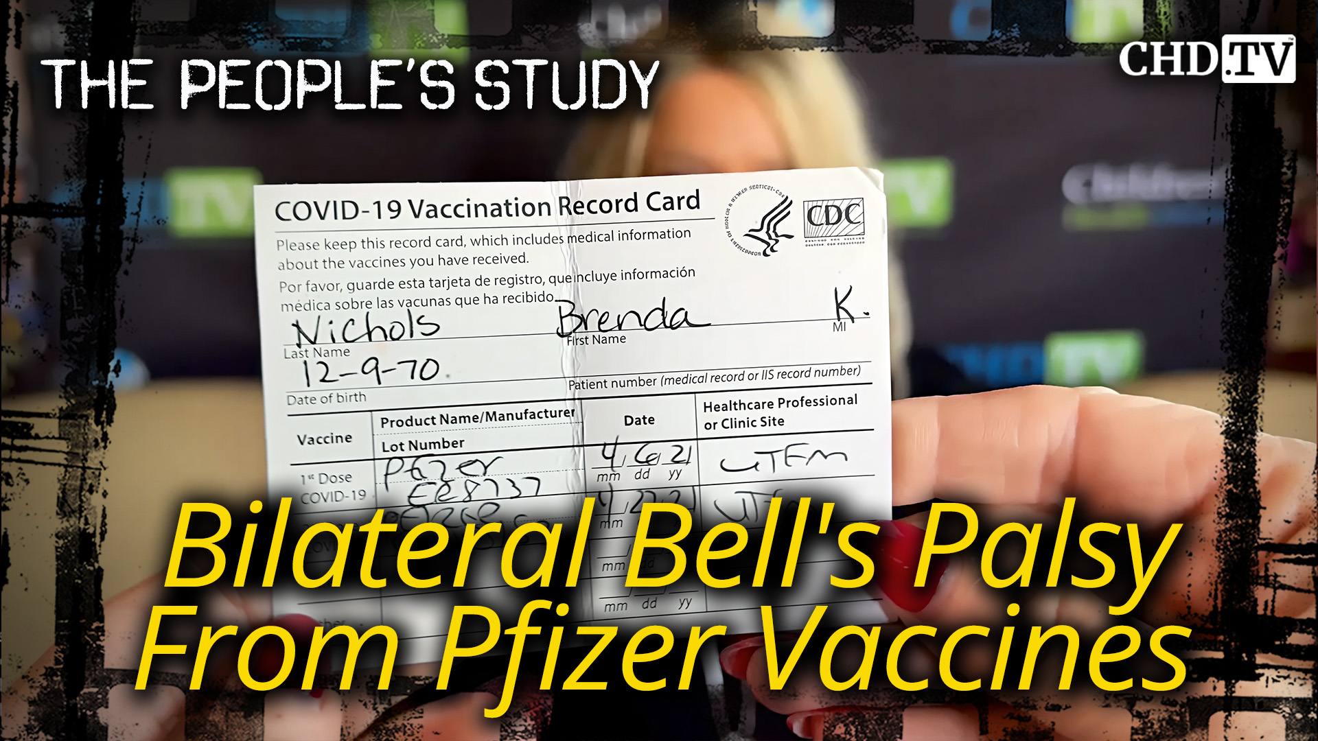 Bilateral Bell’s Palsy From Pfizer Vaccines