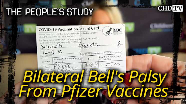 Bilateral Bell’s Palsy From Pfizer Vaccines