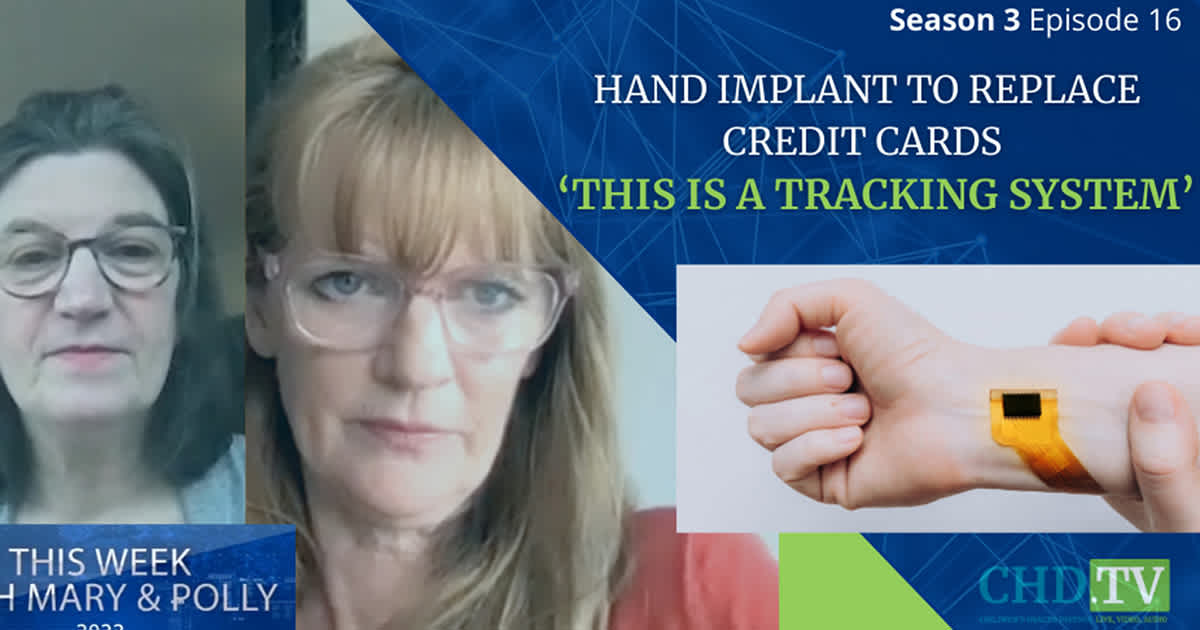 ‘This Is a Tracking System’ — Hand Implant Allows People to Pay With Chip + More