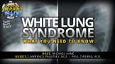 White Lung Syndrome: What You Need To Know