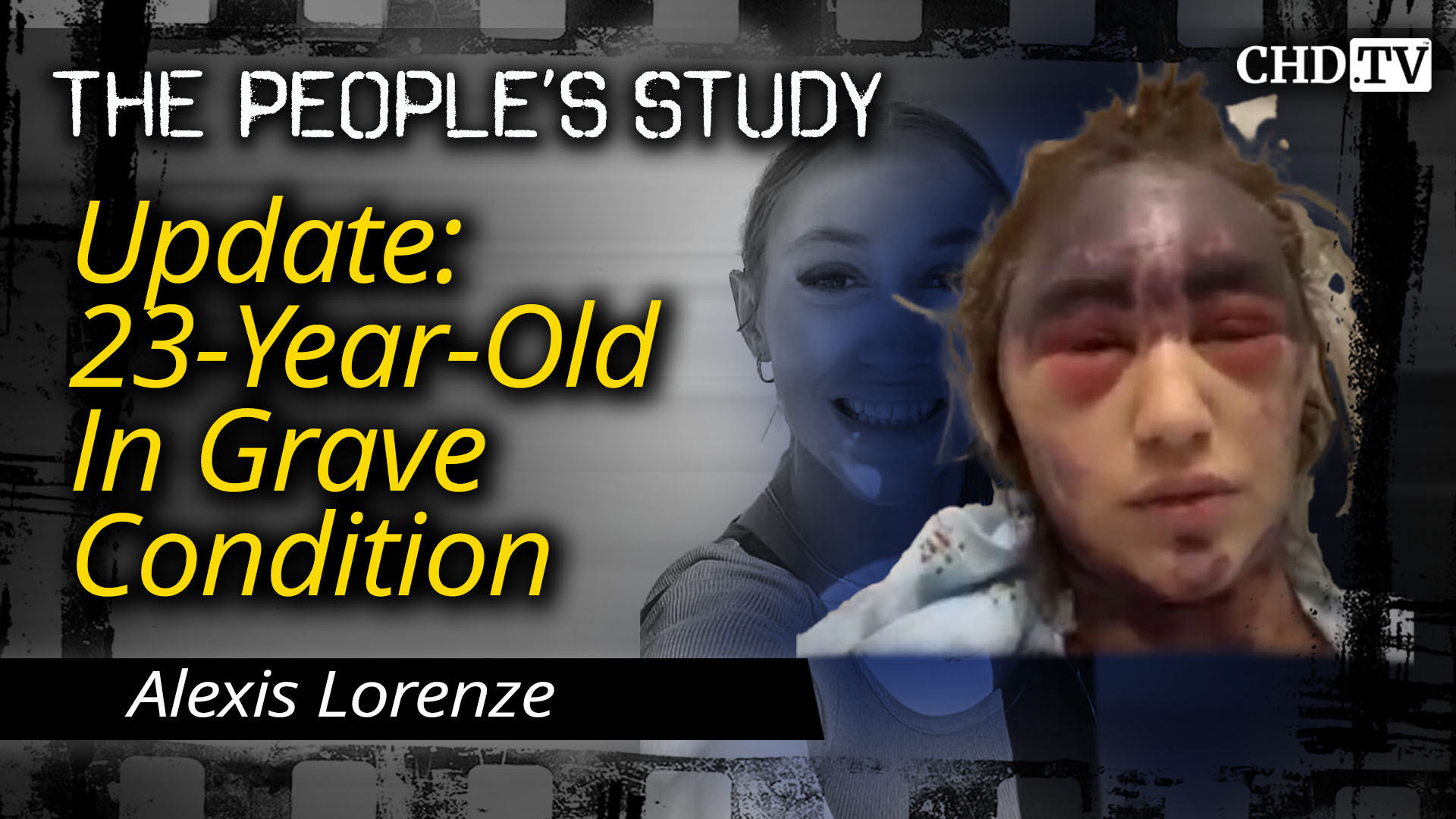 Update: 23-Year-Old in Grave Condition