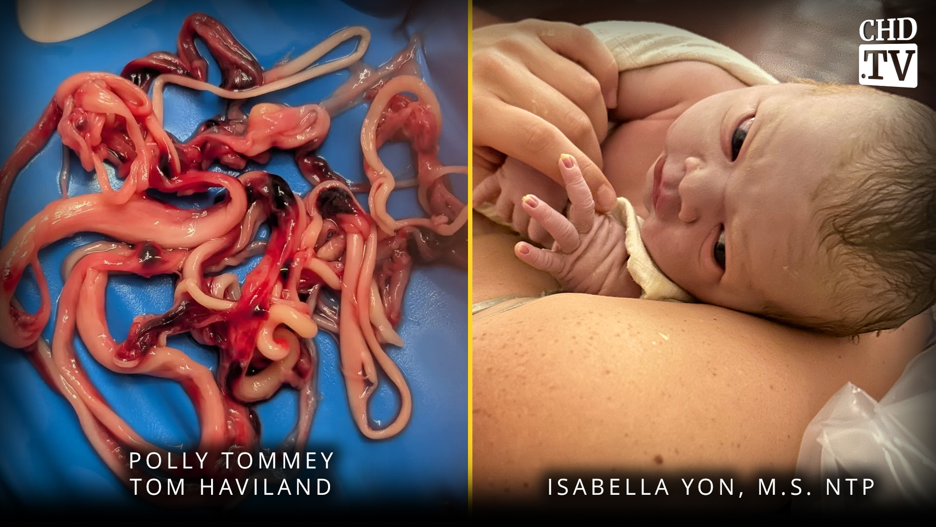Embalmers Worldwide Finding White Fibrous Clots + Mothers 2B Returns