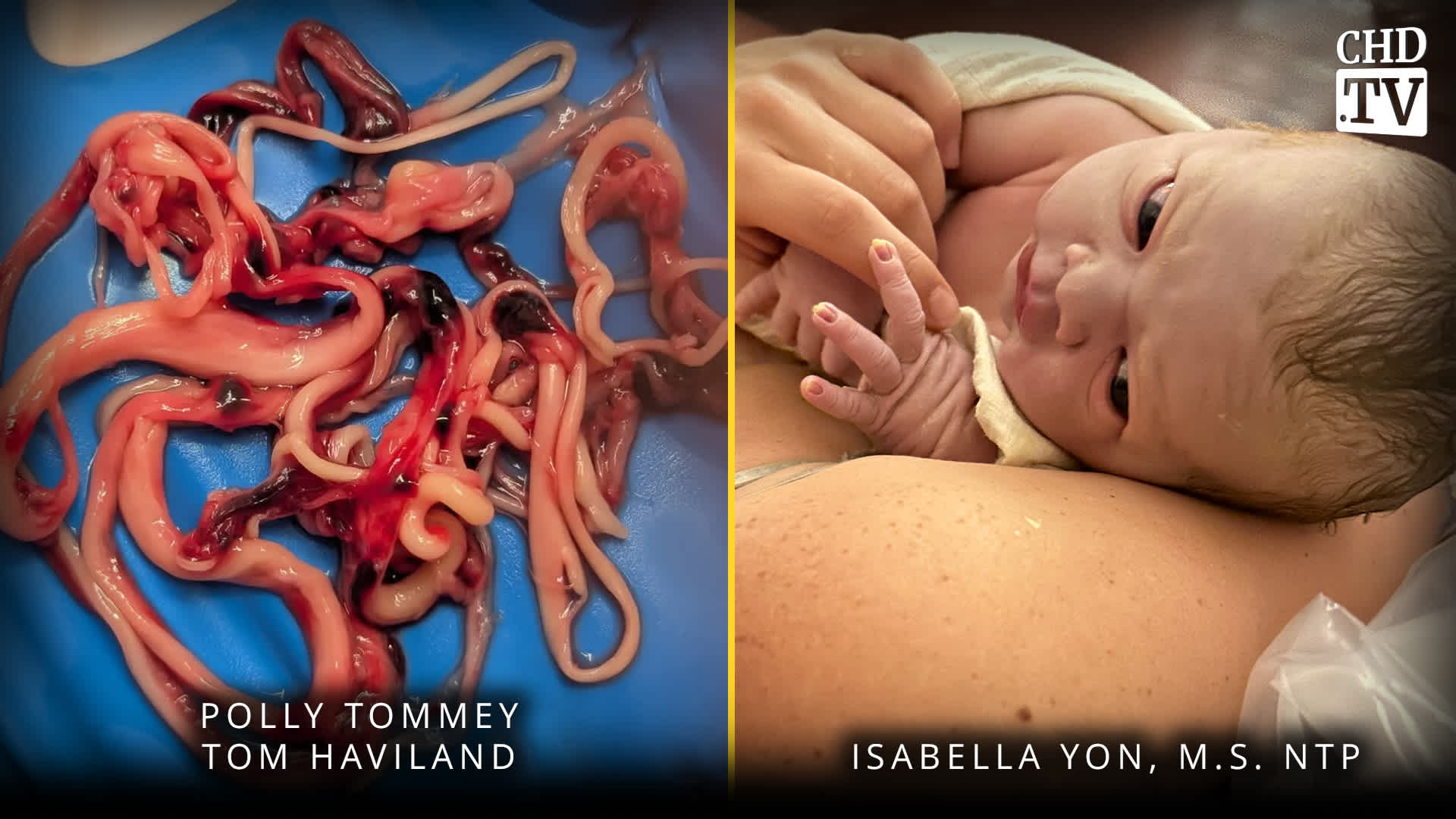 Embalmers Worldwide Finding White Fibrous Clots + Mothers 2B Returns